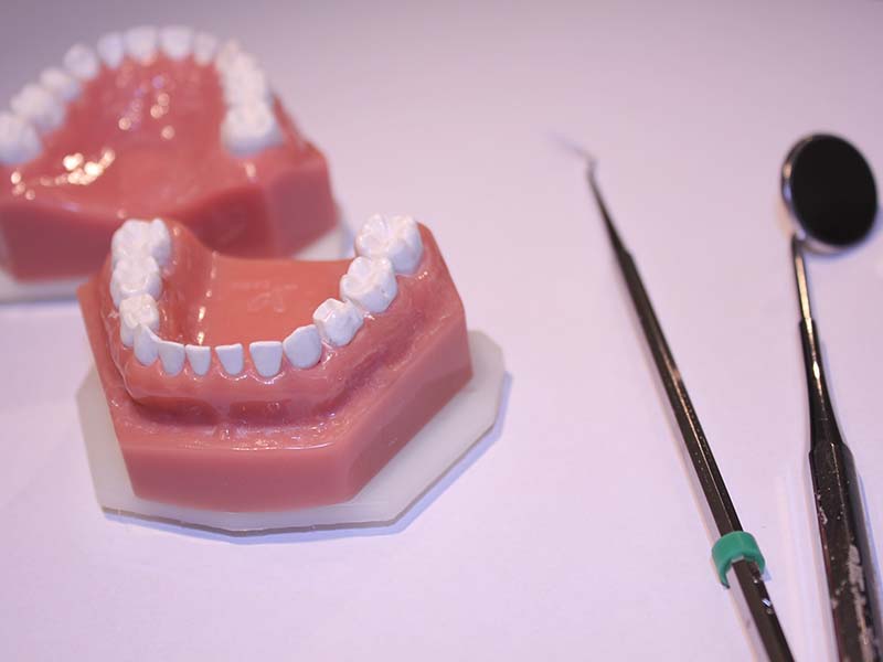 Einfache Dinge, die kluge Zahnärzte tun: Optimierte Kariestherapien in der Kinderzahnheilkunde